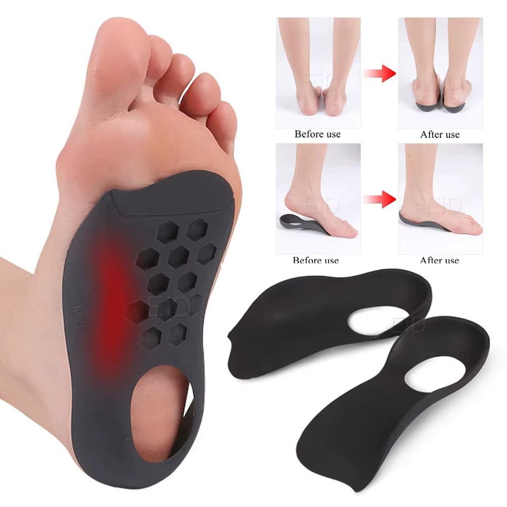 Xo-Legs Orthopedic Insoles Orthotics Flat Foot Health Sole Pad for Shoes Insert Arch Support Pad for Plantar Fasciitis Feet Care